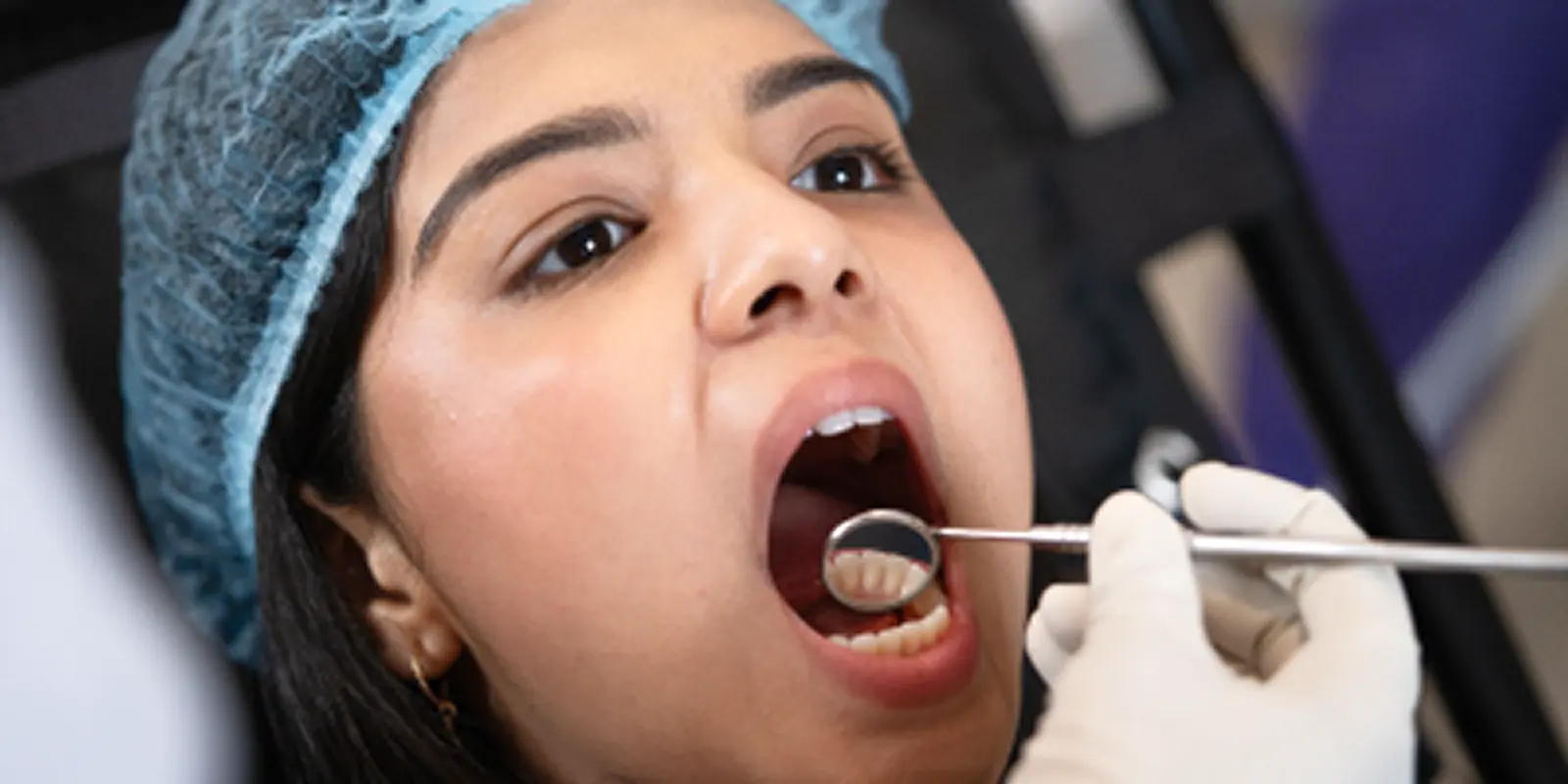 Teeth plaque and calculus removal at home